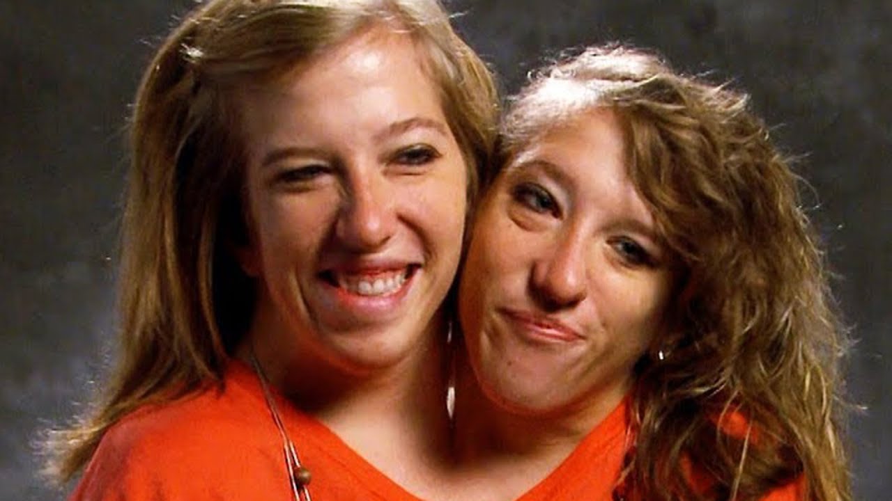 Abby & Brittany: Where Are the Conjoined Twins Now? 